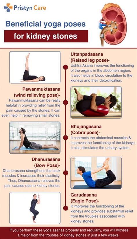 Kidney Stone Pain Relief Position