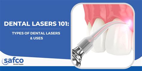 Laser Dentistry USA: Revolutionary Oral Care