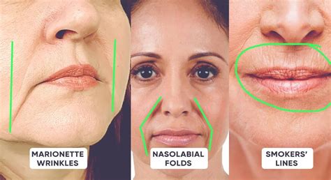 Fixing Nasolabial Folds With Makeup: A Stepbystep Guide