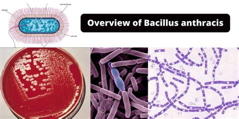 Where Does Bacillus Anthracis Live Understanding Its Natural Habitat