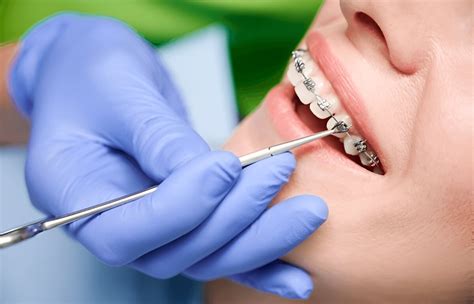 Best Orthodontic Treatment Near Me: Local Expertise