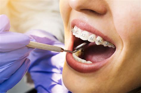 Top Dentist Reveals Best Orthodontic Treatment Options