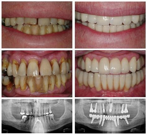 Advanced Periodontal Treatment: Revolutionary Solutions for Gum Health