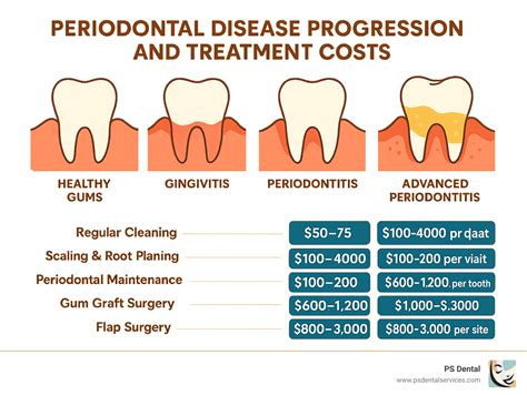 Periodontal Treatment Cost in Australia: What You Need to Know