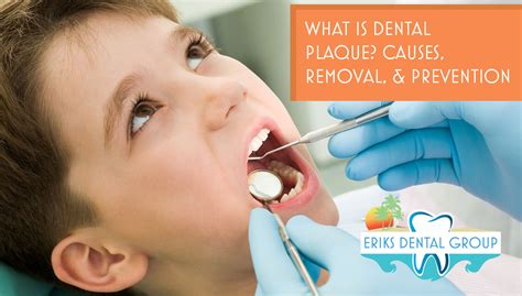 Top Plaque Removal Prevention Tips