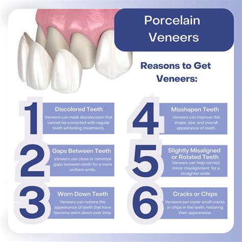 Porcelain Veneers: Speedy Recovery Time Revealed