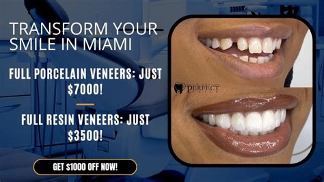 Porcelain Veneers Treatment Cost Explained Simply