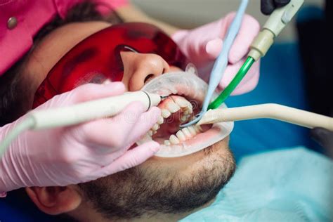 Unlock Expert Tips for Professional Teeth Cleaning from Top Dentists