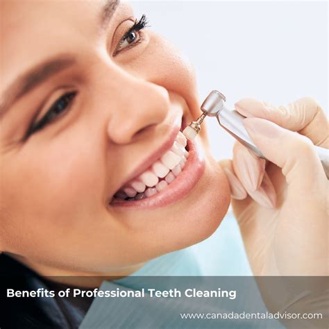 Professional Teeth Cleaning: Long-Term Care Secrets