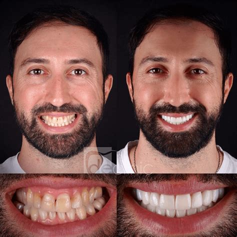 Top Smile Makeover Best Clinic Near You: Transform Your Smile Today