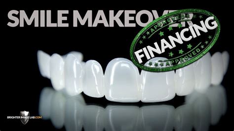 Best Smile Makeover Financing Options Revealed
