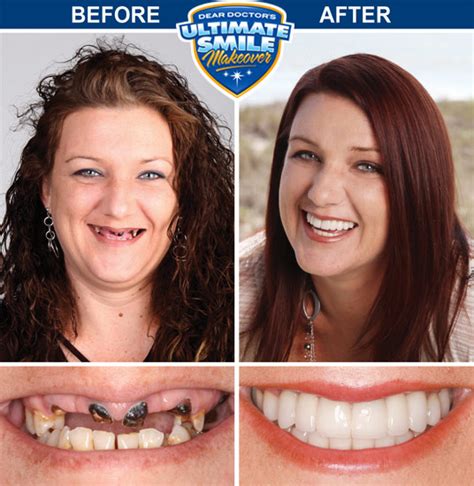 Smile Makeover Success with Top Dentist: Transform Your Smile Today