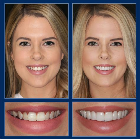 Top Smile Makeover Clinics in USA Reveal Amazing Transformations