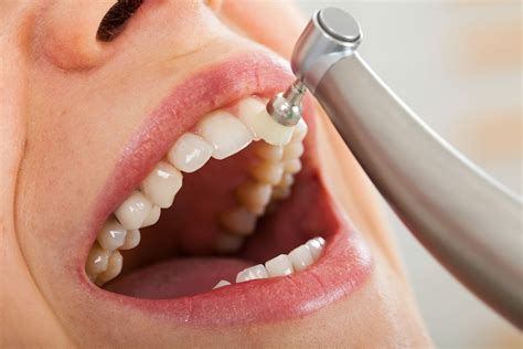 Best Teeth Cleaning Treatment for Optimal Oral Health