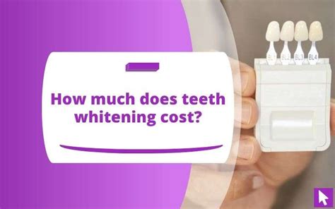 UK Teeth Whitening Treatment Cost Secrets