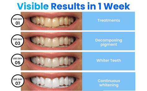 Same Day Teeth Whitening Treatment Available Now!