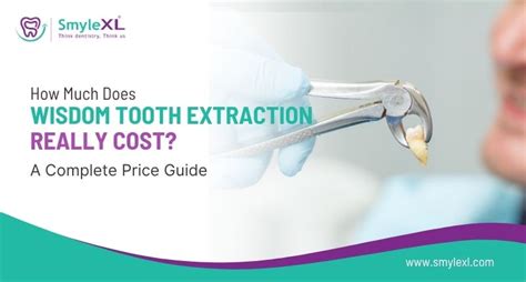 Same Day Tooth Extraction Cost Unveiled!
