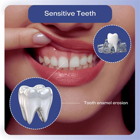 Tooth Sensitivity for Sensitive Teeth: Simple Relief Strategies You Need to Know