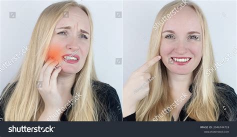 Toothache Before and After: Real Results and Relief Strategies