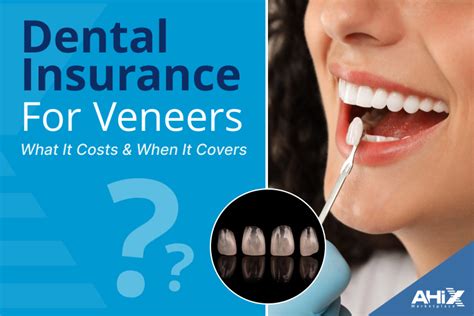 Veneers for Teeth Insurance Coverage: What You Need to Know