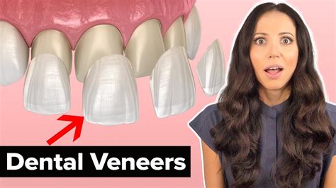 Veneers for Teeth Procedure Explained: Your Guide to Perfect Smiles