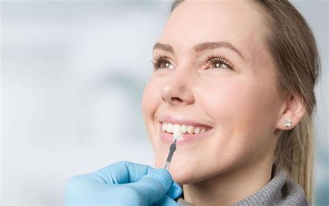 Veneers Recovery Time: What to Expect