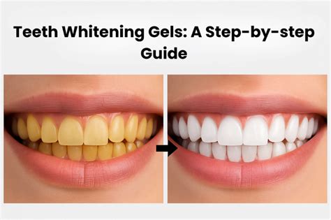 Ultimate Guide to Whitening Teeth Step by Step