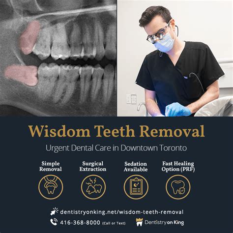 Wisdom Tooth Removal Toronto: Your Top Choice Guide